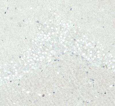 Immunohistochemistry-Paraffin: SATB2 Antibody (CL0319) [NBP2-52913]