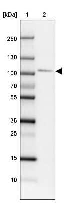 Western Blot: SATB2 Antibody (CL0319) [NBP2-52913]