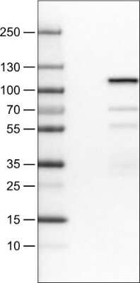 Western Blot: SATB2 Antibody (CL0319) [NBP2-52913]