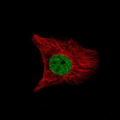 Immunocytochemistry/ Immunofluorescence: SATB2 Antibody (CL0320) [NBP2-52914]