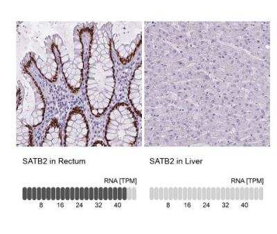Immunohistochemistry-Paraffin: SATB2 Antibody (CL0320) [NBP2-52914]