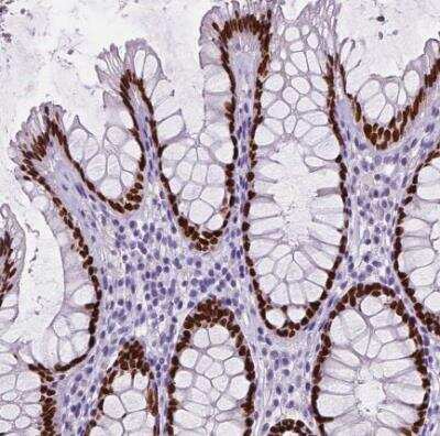 Immunohistochemistry-Paraffin: SATB2 Antibody (CL0320) [NBP2-52914]