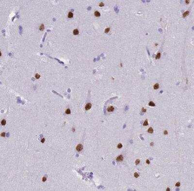 Immunohistochemistry-Paraffin: SATB2 Antibody (CL0320) [NBP2-52914]