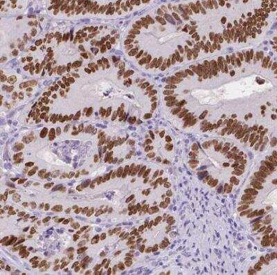 Immunohistochemistry-Paraffin: SATB2 Antibody (CL0320) [NBP2-52914]