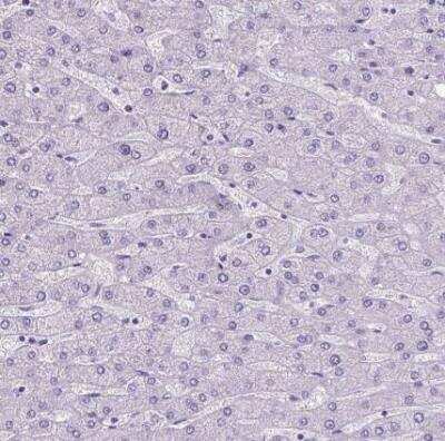 Immunohistochemistry-Paraffin: SATB2 Antibody (CL0320) [NBP2-52914]