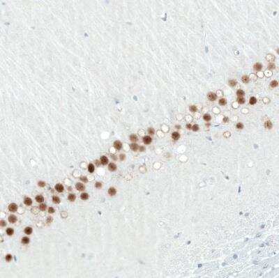 Immunohistochemistry-Paraffin: SATB2 Antibody (CL0320) [NBP2-52914]