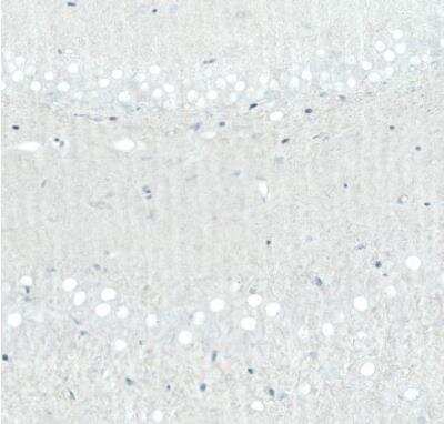 Immunohistochemistry-Paraffin: SATB2 Antibody (CL0320) [NBP2-52914]