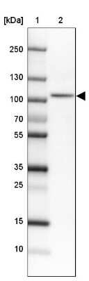 Western Blot: SATB2 Antibody (CL0320) [NBP2-52914]