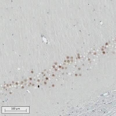 Immunohistochemistry-Paraffin: SATB2 Antibody (CL0321) [NBP2-52915]