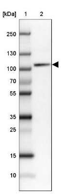 Western Blot: SATB2 Antibody (CL0321) [NBP2-52915]