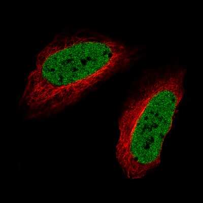 Immunocytochemistry/ Immunofluorescence: SATB2 Antibody (CL0323) [NBP2-52916]
