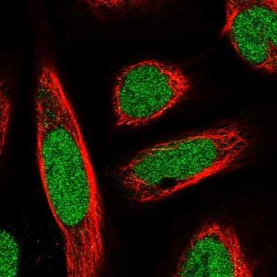 Immunocytochemistry/ Immunofluorescence: SATB2 Antibody [NBP1-92365]