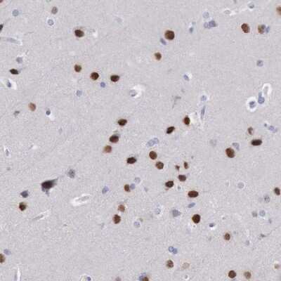 Immunohistochemistry-Paraffin: SATB2 Antibody [NBP1-83619]