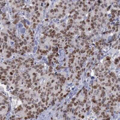 Immunohistochemistry-Paraffin: SATB2 Antibody [NBP1-83619]