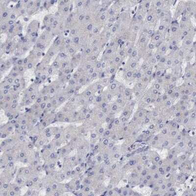 Immunohistochemistry-Paraffin: SATB2 Antibody [NBP1-83619]