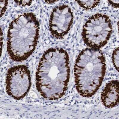 Immunohistochemistry-Paraffin: SATB2 Antibody [NBP1-83619]