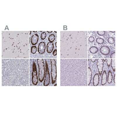Immunohistochemistry-Paraffin: SATB2 Antibody [NBP1-83619]