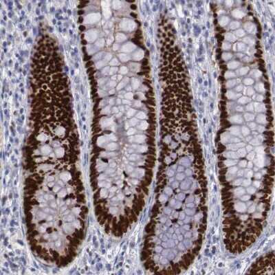 Immunohistochemistry-Paraffin: SATB2 Antibody [NBP1-83619]