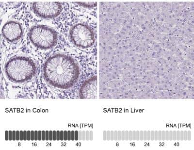 Immunohistochemistry-Paraffin: SATB2 Antibody [NBP1-92365]