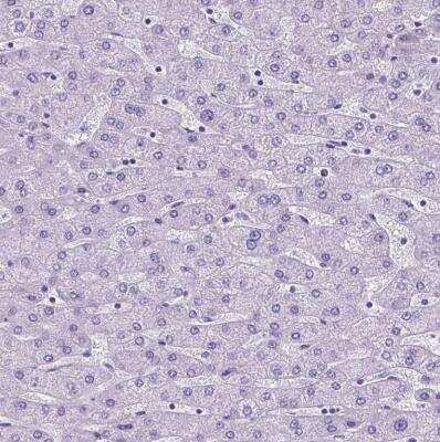 Immunohistochemistry-Paraffin: SATB2 Antibody [NBP1-92365]