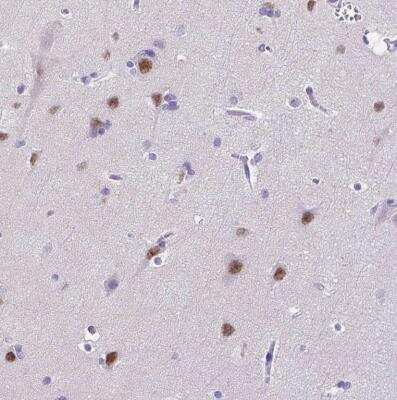 Immunohistochemistry-Paraffin: SATB2 Antibody [NBP1-92365]