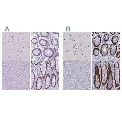 Immunohistochemistry-Paraffin: SATB2 Antibody [NBP1-92365]