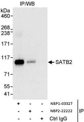 Immunoprecipitation: SATB2 Antibody [NBP1-03327]