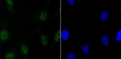 Immunocytochemistry/ Immunofluorescence: SATB2 Antibody (JM52-44) [NBP2-75657]