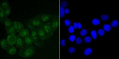 Immunocytochemistry/ Immunofluorescence: SATB2 Antibody (JM52-44) [NBP2-75657]