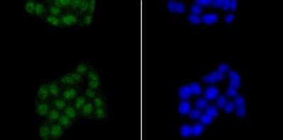 Immunocytochemistry/ Immunofluorescence: SATB2 Antibody (JM52-44) [NBP2-75657]