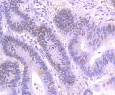Immunohistochemistry-Paraffin: SATB2 Antibody (JM52-44) [NBP2-75657]