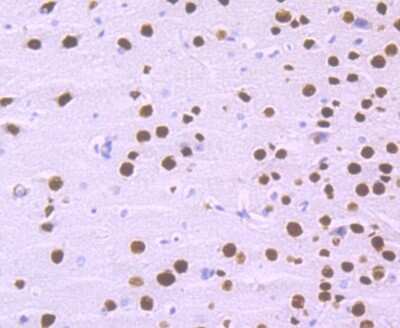 Immunohistochemistry-Paraffin: SATB2 Antibody (JM52-44) [NBP2-75657]