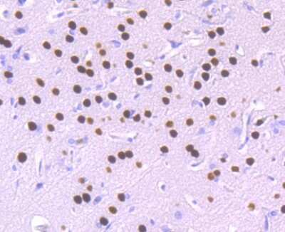 Immunohistochemistry-Paraffin: SATB2 Antibody (JM52-44) [NBP2-75657]