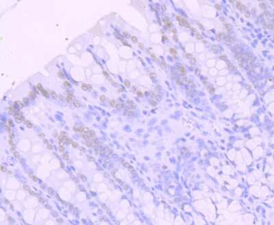 Immunohistochemistry-Paraffin: SATB2 Antibody (JM52-44) [NBP2-75657]