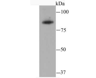 Western Blot: SATB2 Antibody (JM52-44) [NBP2-75657]