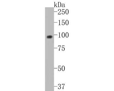 Western Blot: SATB2 Antibody (JM52-44) [NBP2-75657]