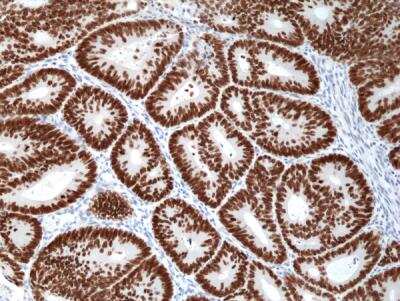 Immunohistochemistry-Paraffin: SATB2 Antibody (RM365) [NBP2-77427]