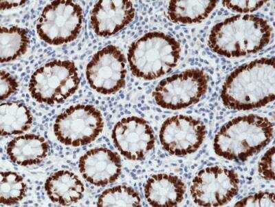 Immunohistochemistry-Paraffin: SATB2 Antibody (RM365) [NBP2-77427]