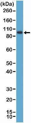 Western Blot: SATB2 Antibody (RM365) [NBP2-77427]