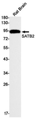 Western Blot: SATB2 Antibody (S02-1H5) [NBP3-19525]