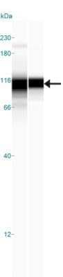 Simple Western: SATB2 Antibody [NBP1-83619]