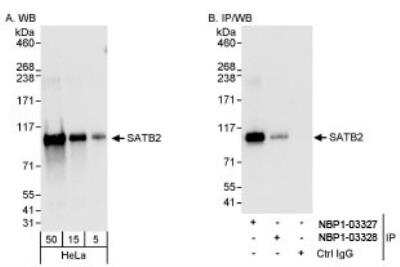 Western Blot: SATB2 Antibody [NBP1-03328]