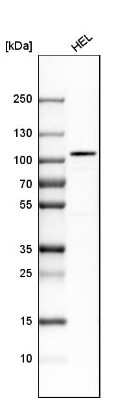 Western Blot: SATB2 Antibody [NBP1-83619]