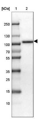 Western Blot: SATB2 Antibody [NBP1-92365]