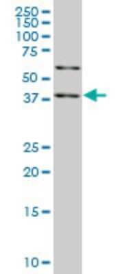 Western Blot: SAV1 Antibody (3A10) [H00060485-M04]