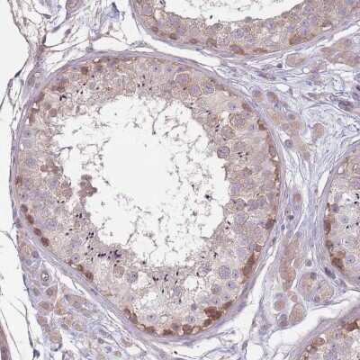 Immunohistochemistry-Paraffin: SAV1 Antibody [NBP2-13282]