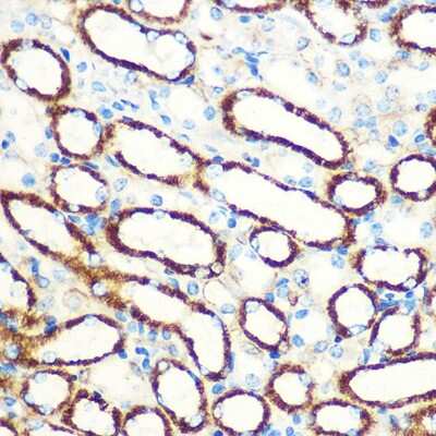 Immunohistochemistry-Paraffin: SAV1 Antibody - Azide and BSA Free [NBP3-15584]