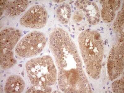 Immunohistochemistry: SAV1 Antibody (OTI2B7) - Azide and BSA Free [NBP2-73998]