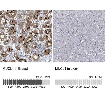 Immunohistochemistry-Paraffin: SBEM Antibody [NBP1-92366]