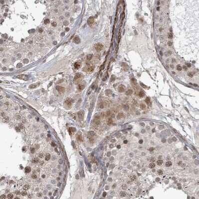 Immunohistochemistry-Paraffin: SBF2 Antibody [NBP2-13283]